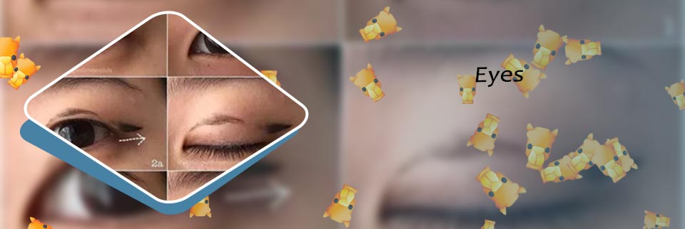White waterline eye
